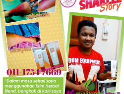 Krim Surut Bengkak: Pilihan Terbaik untuk Meredakan Nyeri dan Pembengkakan