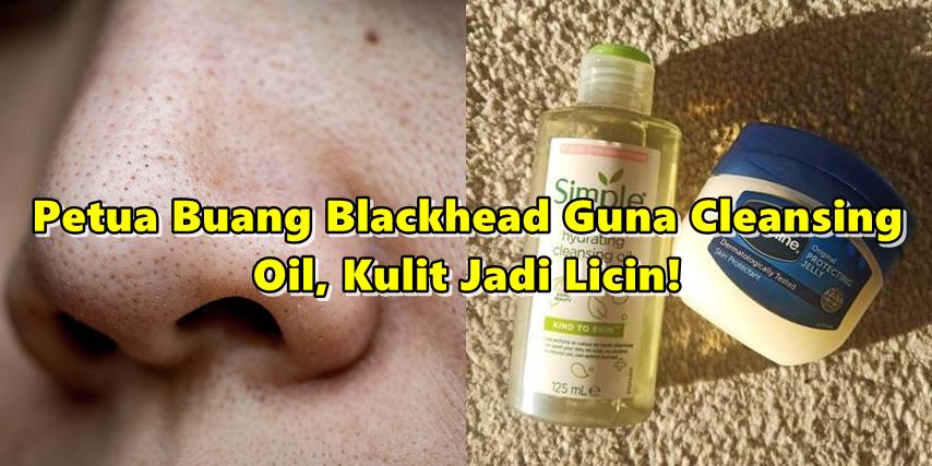 buang blackhead